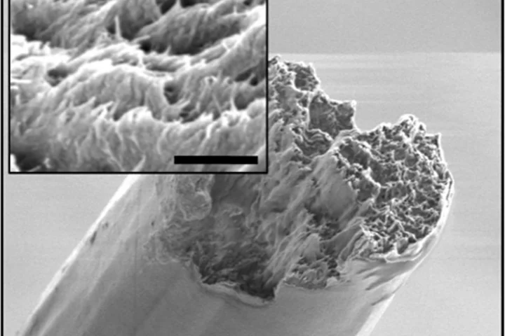 A scanning electron microscope image of the cellulose nanofiber material, derived from wood, which is now the strongest biomaterial ever made