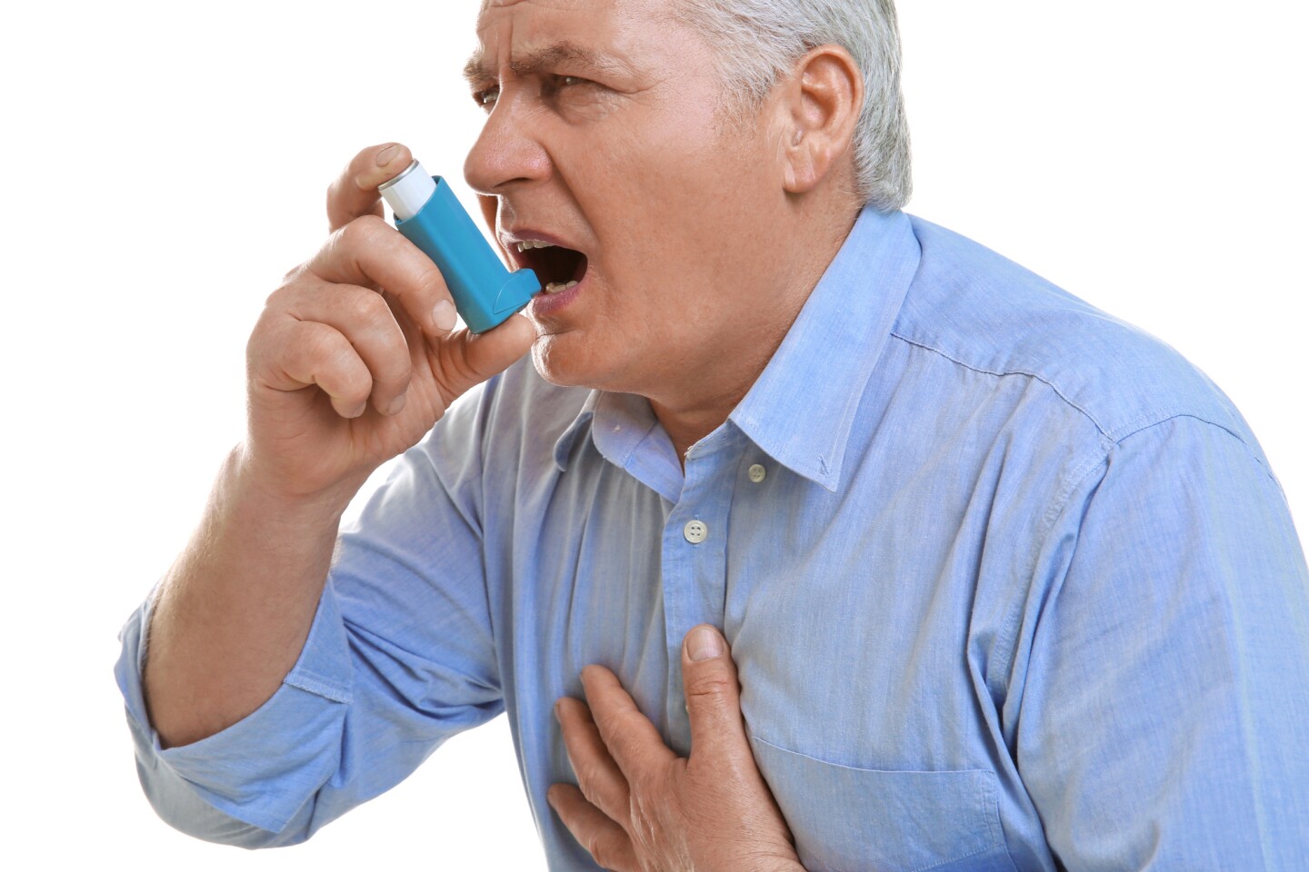 Researchers found that severe asthmatics were able to reduce their dose of inhaled steroids after receiving a biologic therapy