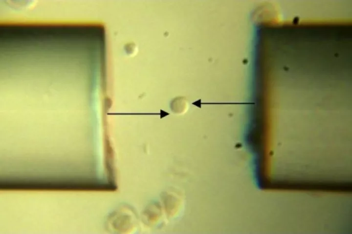 A smooth muscle cell, trapped between the fiber-optic spanner's two offset optical fibers (Image: Optics Letters)