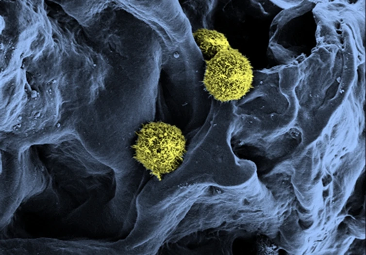 Scanning electron microscopy of stem cells (yellow / green) in a scaffold structure (blue) serving as a basis for the artificial bone marrow (Photo: C. Lee-Thedieck/KIT)