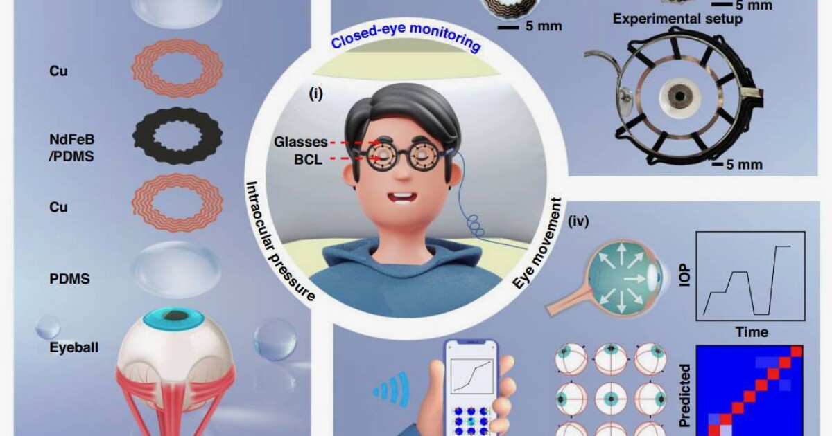 Smart contact lenses monitor glaucoma during sleep