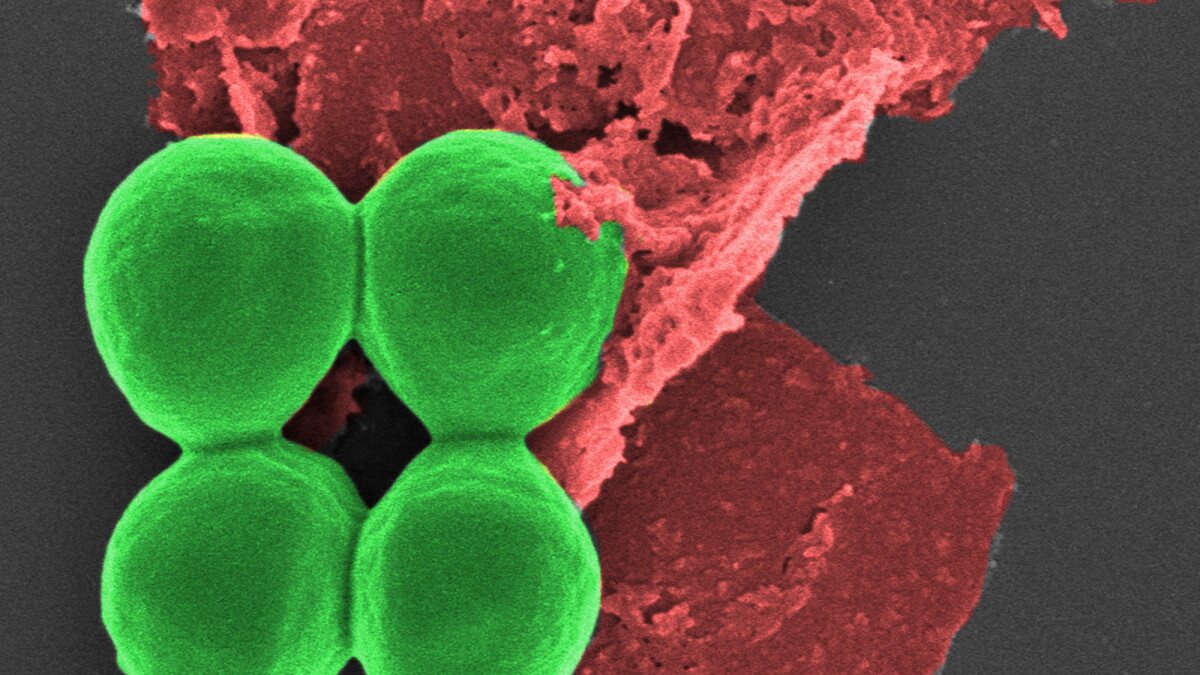 Phosphorus-based nanotech rips apart superbugs & accelerates healing - Vimarsana News