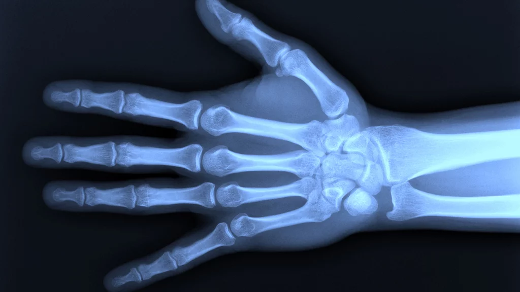 New technology based on the eye of a moth improves the quality of X-ray images without compromising the patient's safety (Photo: Shutterstock)