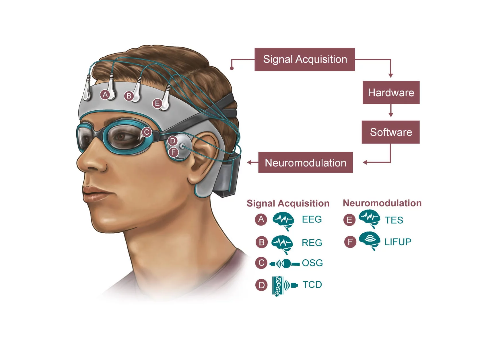 A diagram illustrating what the new sleep-tracking skullcap could look like and how it would work