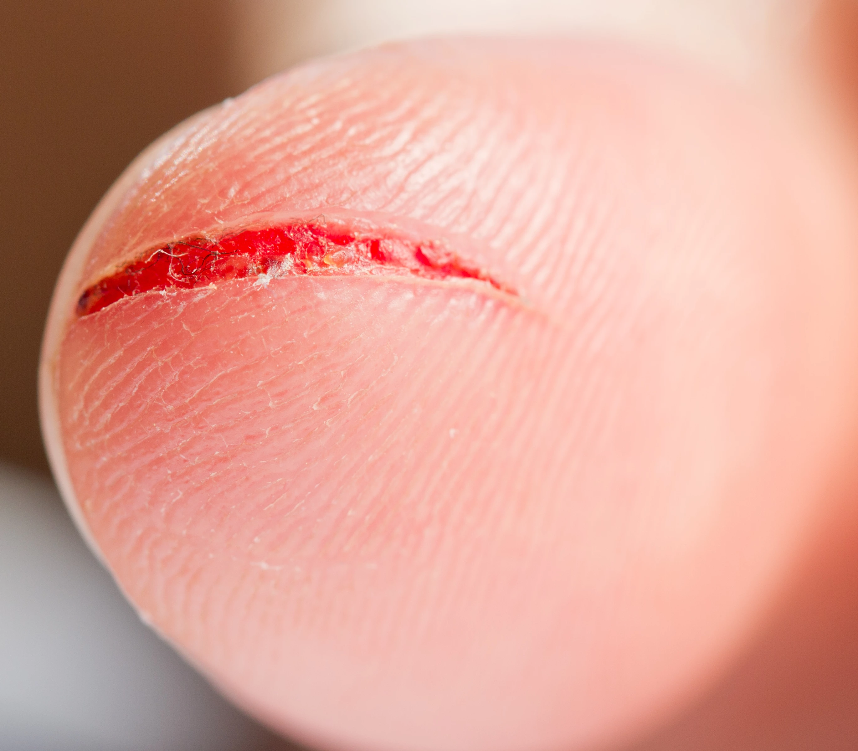 A new plastic demonstrated to the American Chemical Society on Monday not only professes to self-repair when exposed to light, but to change color when damaged in a process akin to the bleeding of human skin (Photo: Shutterstock)