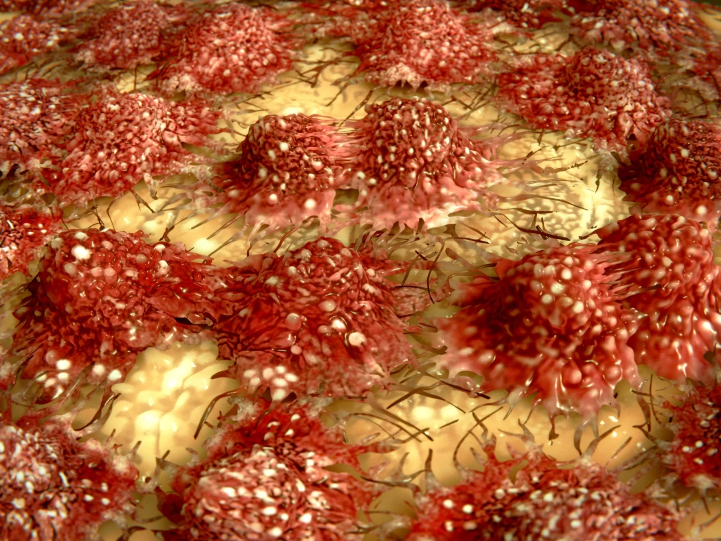 Researchers have found out why a promising class of cancer drugs failed – and how to fix them