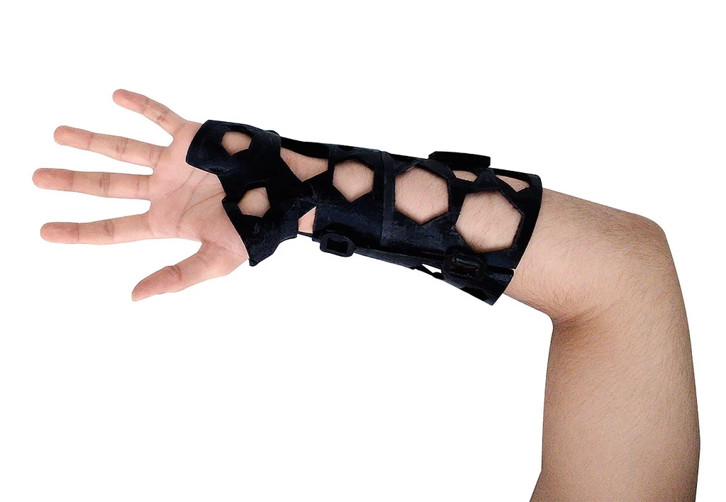 Unlike a plaster cast, the NovaCast is lightweight, well-ventilated and waterproof
