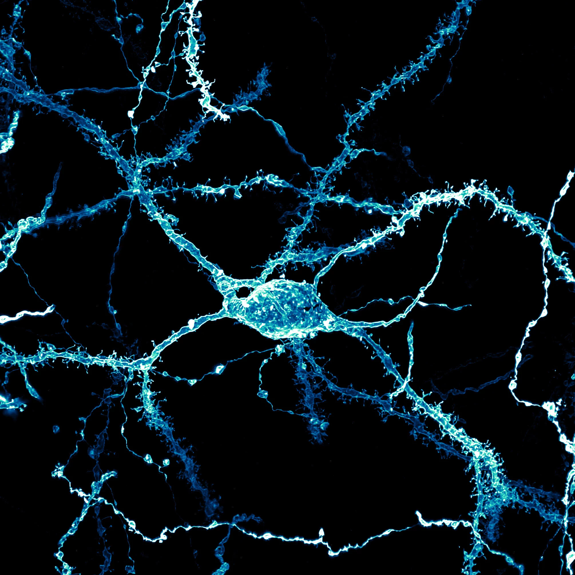 8th place: A neuron densely covered in dendritic spines from the striatum of an adult rat brain