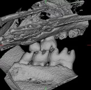 Implant teeth on day 10