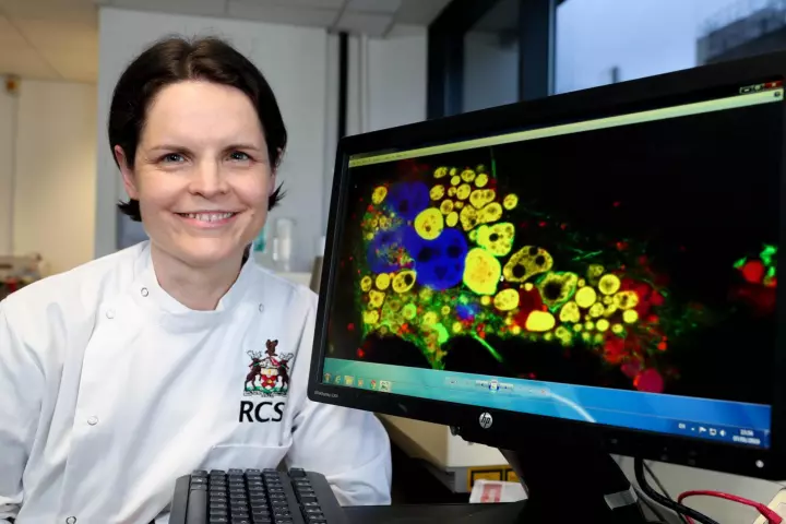 The Royal College of Surgeons in Ireland's Prof. Sally-Ann Cryan, co-lead scientist on the study