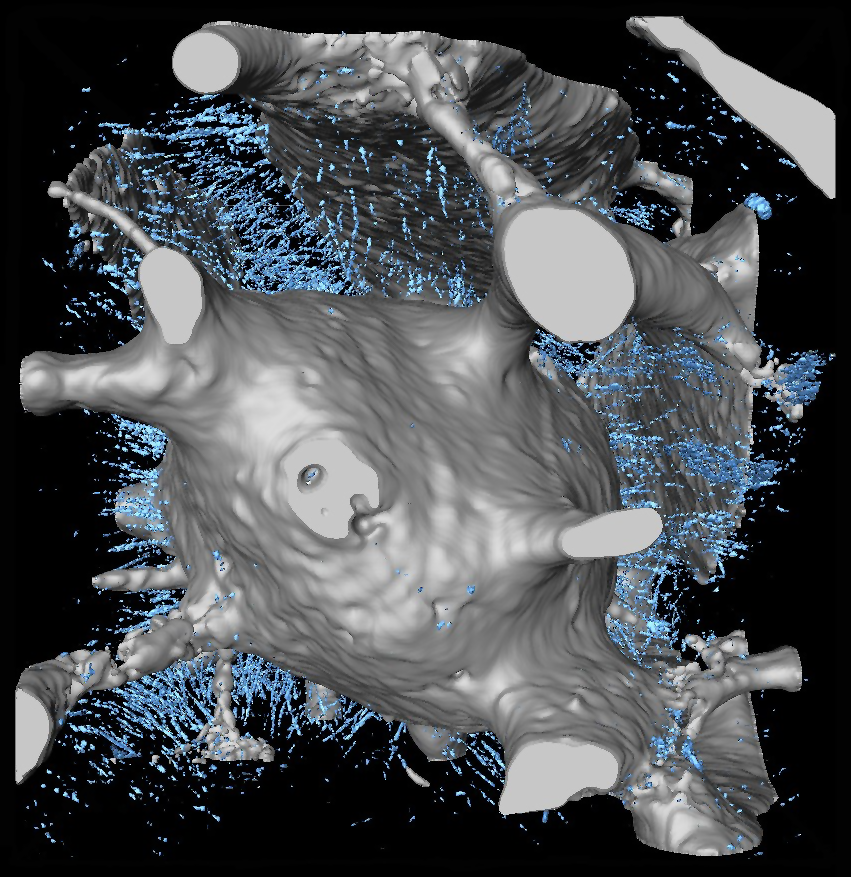 The microscopic structure of the aspidin tissue revealed that it was a type of acellular bone