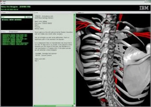 IBM medical visualization software that lets doctors search specific parts of the body