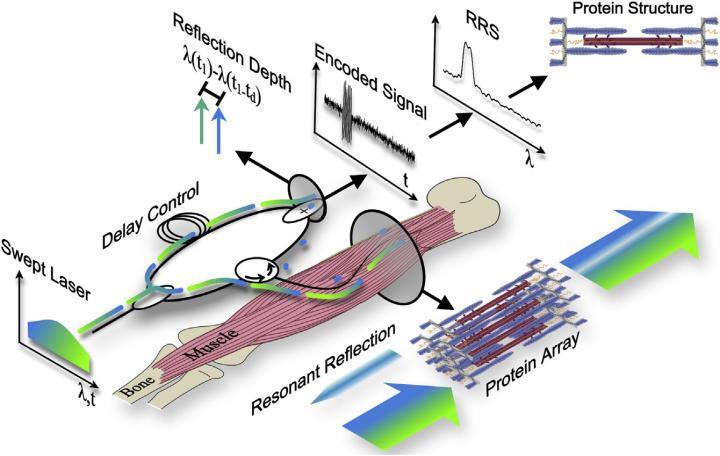 The fiber optic sarcomere length profiler is a minimally invasive alternative to a biopsy, scanning the muscle with a sweeping laser light and studying the returning signals to calculate the length of sarcomeres
