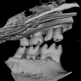 Teeth on day 50