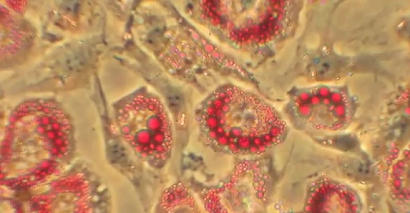 Specially-treated fat cells may one day lead to weight loss