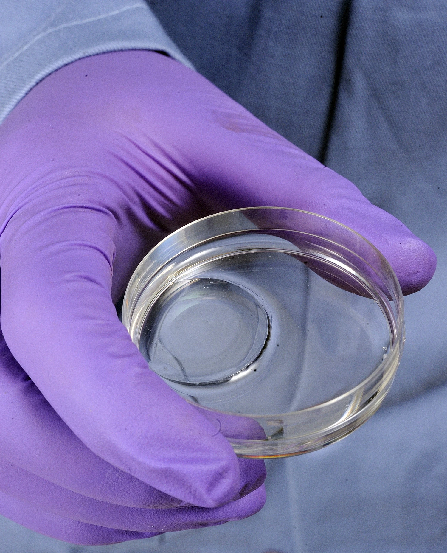 A recently-developed hydrogel allows new skin to grow over third-degree burns