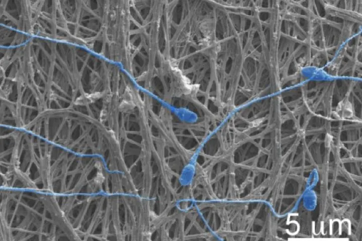 An electron microscope image of the fabric, complete with blocked sperm