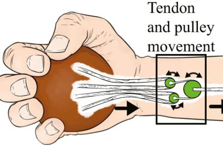 A pulley mechanism developed at OSU may some day be implanted into the hands of people with nerve damage and help them regain a more natural grasping ability with their fingers (Image: OSU)
