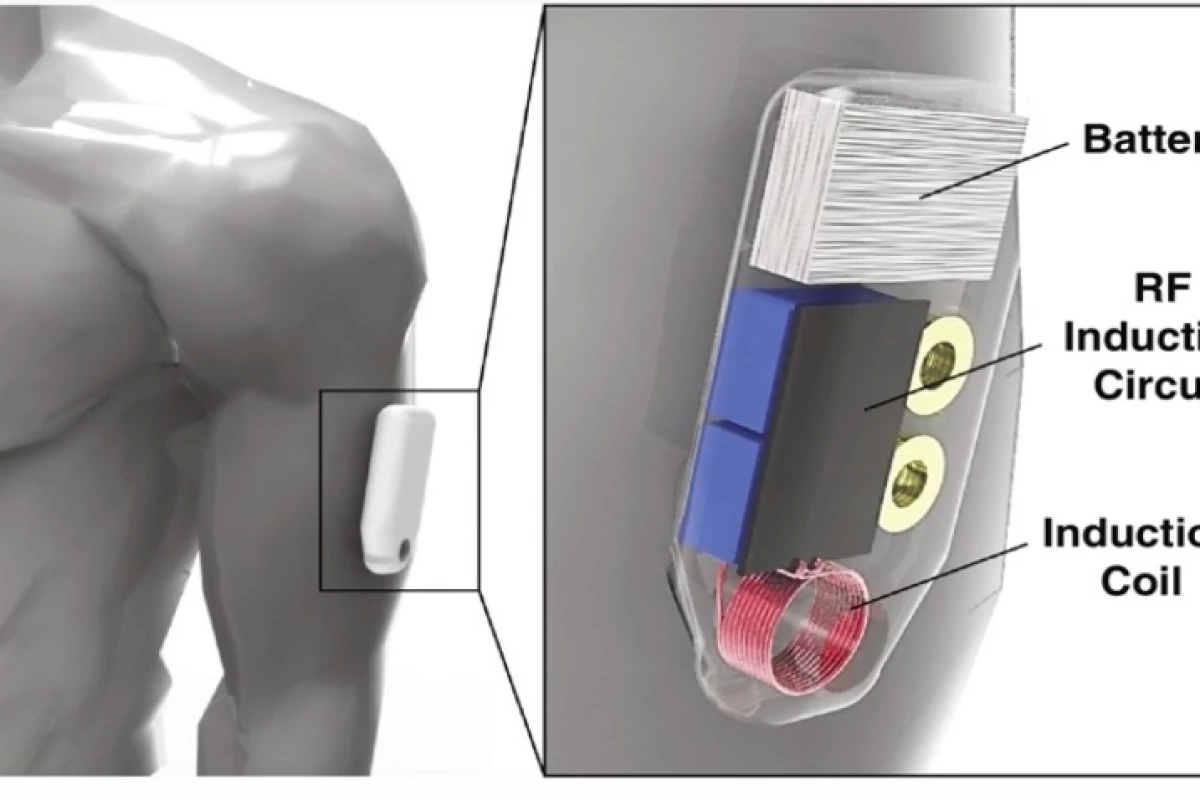A diagram of the system's armband – the separate drug-release capsule has been successfully tested in mice