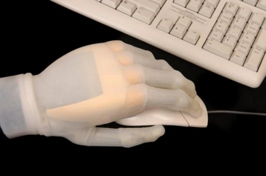 The iLimb hand, from Touch Bionics, allows prosthesis wearers to use a mouse.