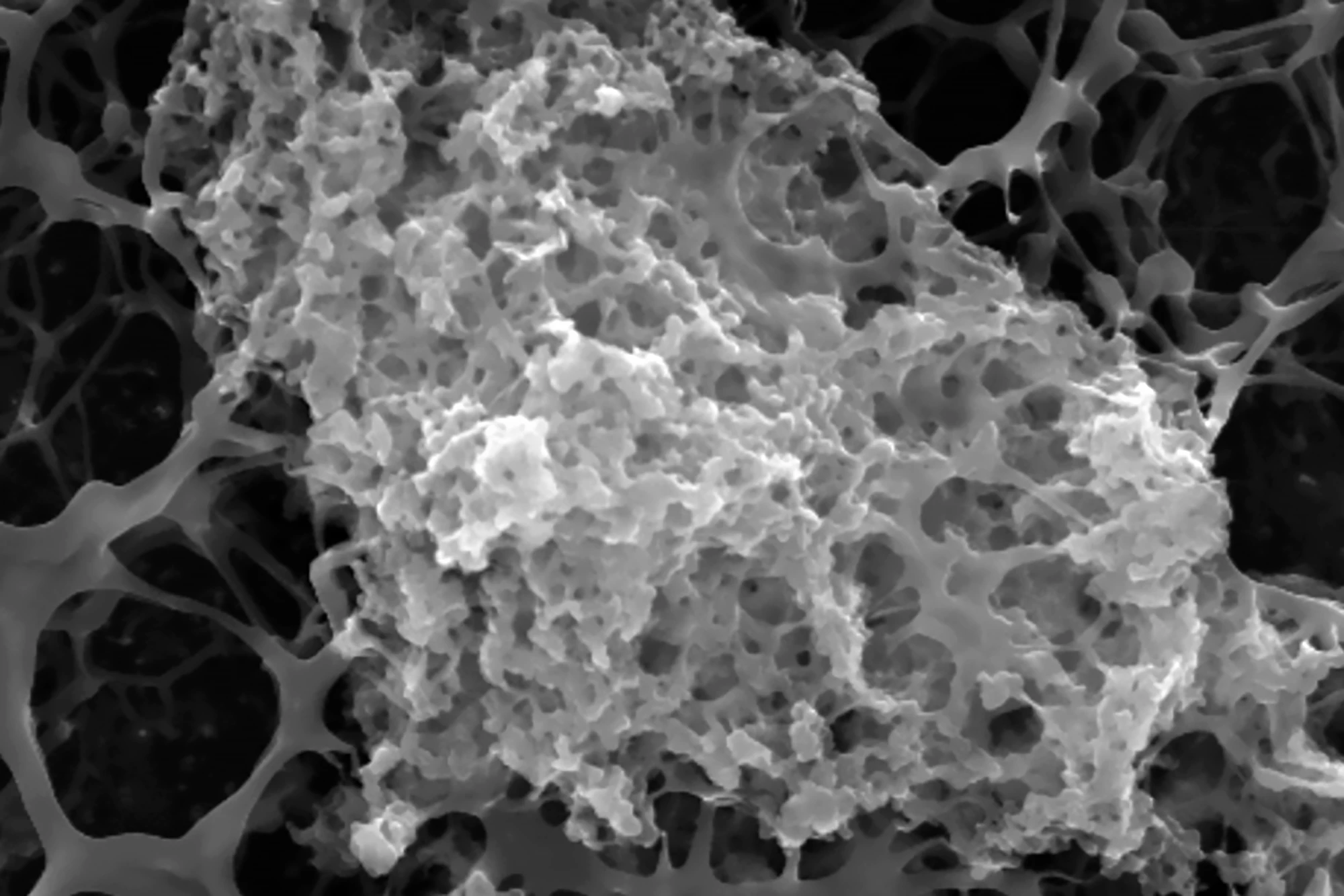 The coacervate resilin-mimetic coating on the base scaffold, magnified 4,000 times under a scanning electron microscope (SEM)