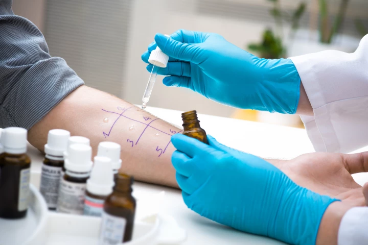 Researchers have found that the extracts used to test for shellfish allergy vary widely between manufacturers