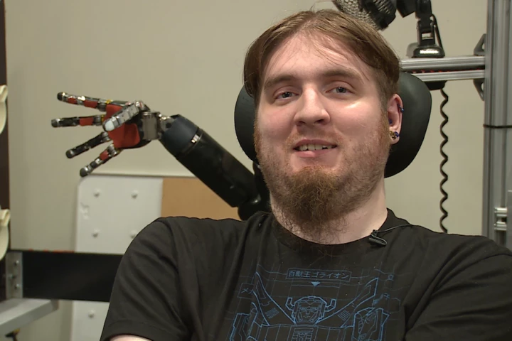 Nathan Copeland, paralyzed for over 10 years, has been able to experience the sensation of touch again through a robotic arm developed by the University of Pittsburgh and UPMC