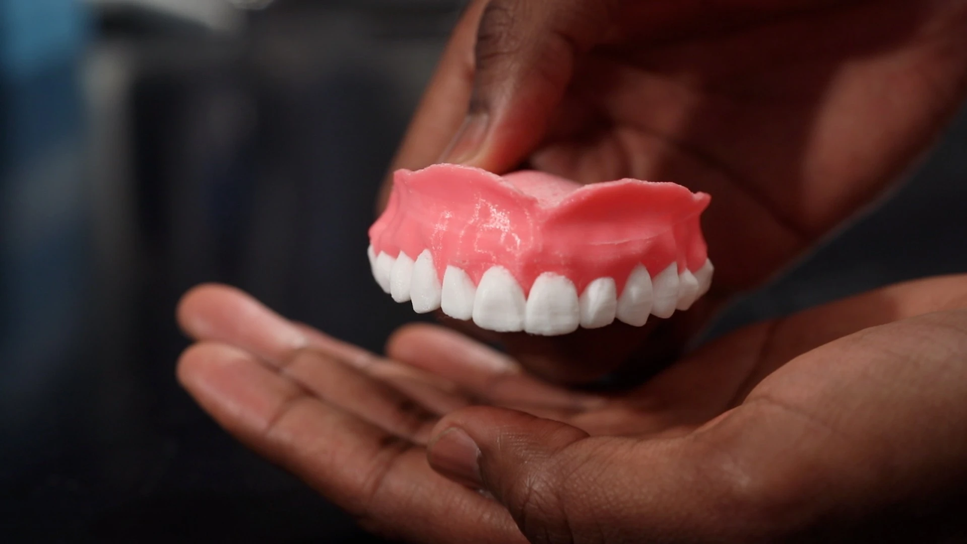The prototype dentures, full of Amphotericin B