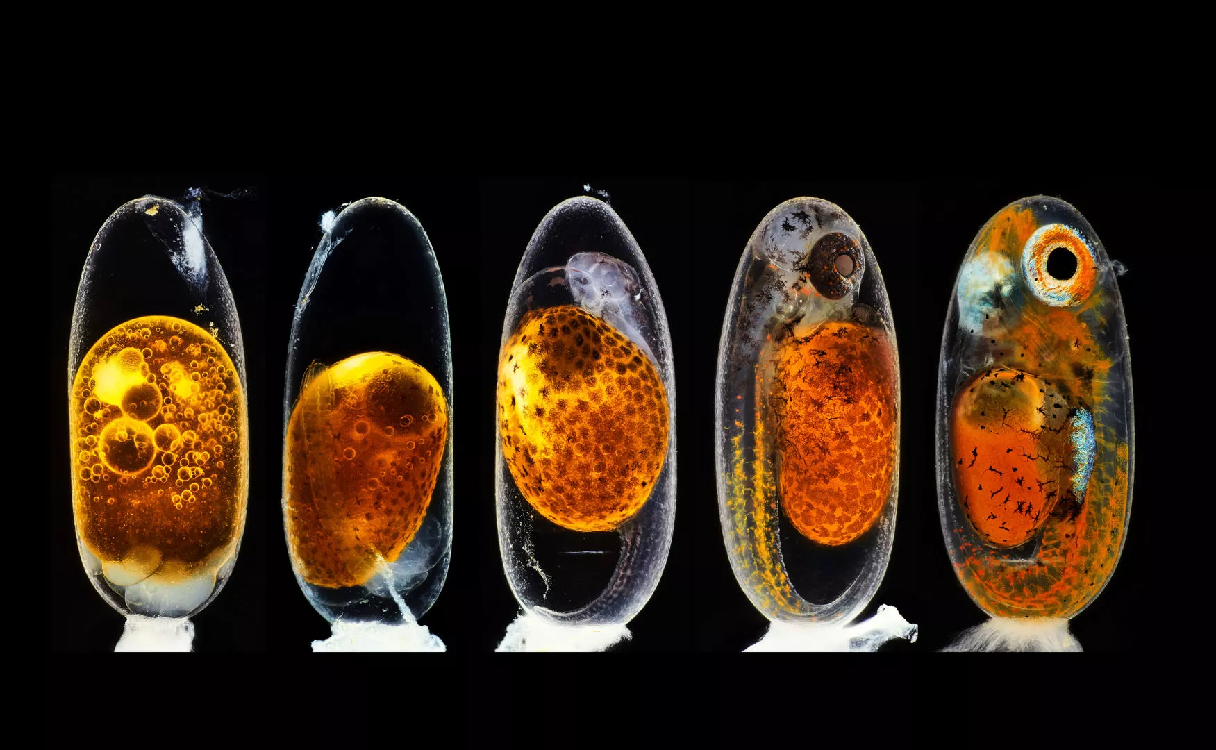 2nd Place. Embryonic development of a clownfish (Amphiprion percula) on days 1, 3 (morning and evening), 5, and 9