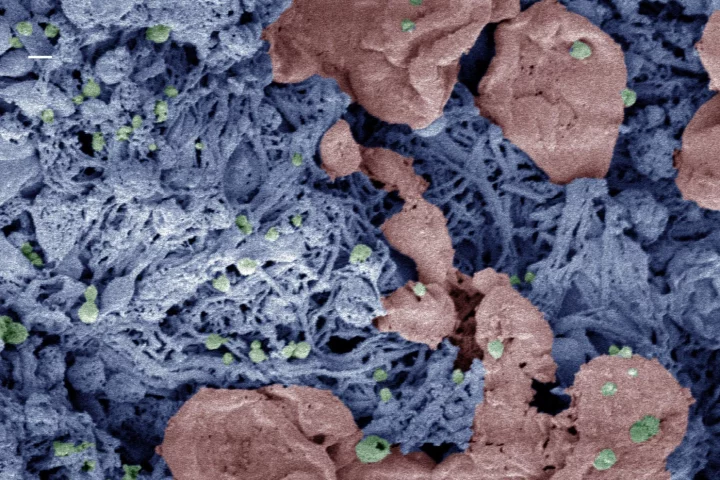 Nanoparticles (green) help form clots in an injured liver, in this color-enhanced microscope image