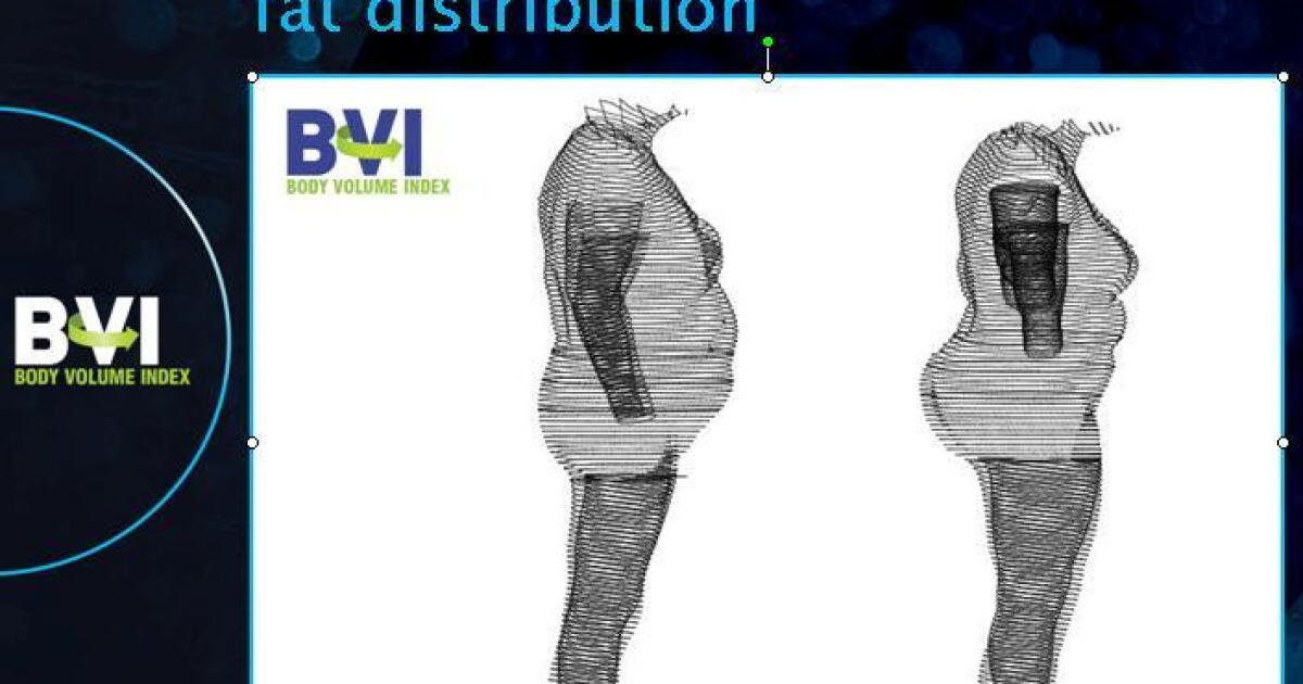 3D scanner-based Body Volume Index launched