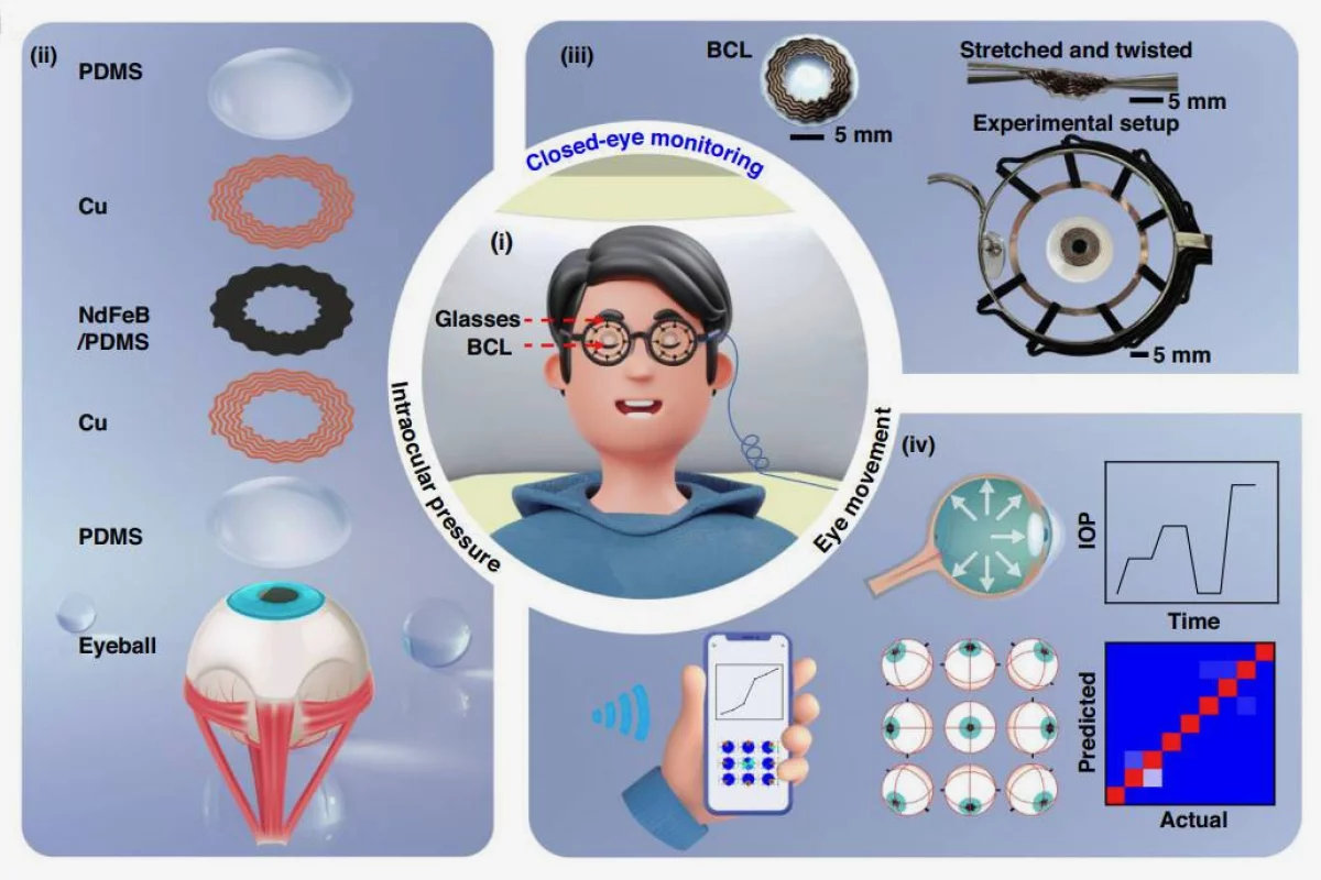 A diagram shows the components of a bimodal contact lens (BCL), along with the manner in which the technology could be used