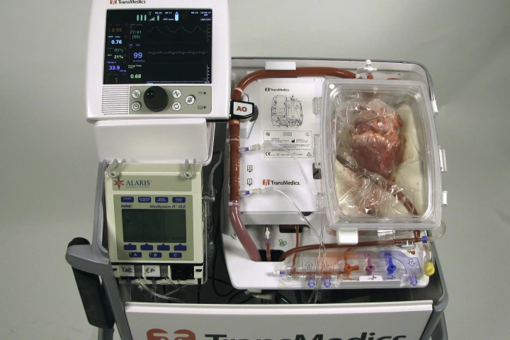 Surgeons have successfully transplanted a "dead" heart into a patient (Photo: Victor Chang Cardiac Research Institute)