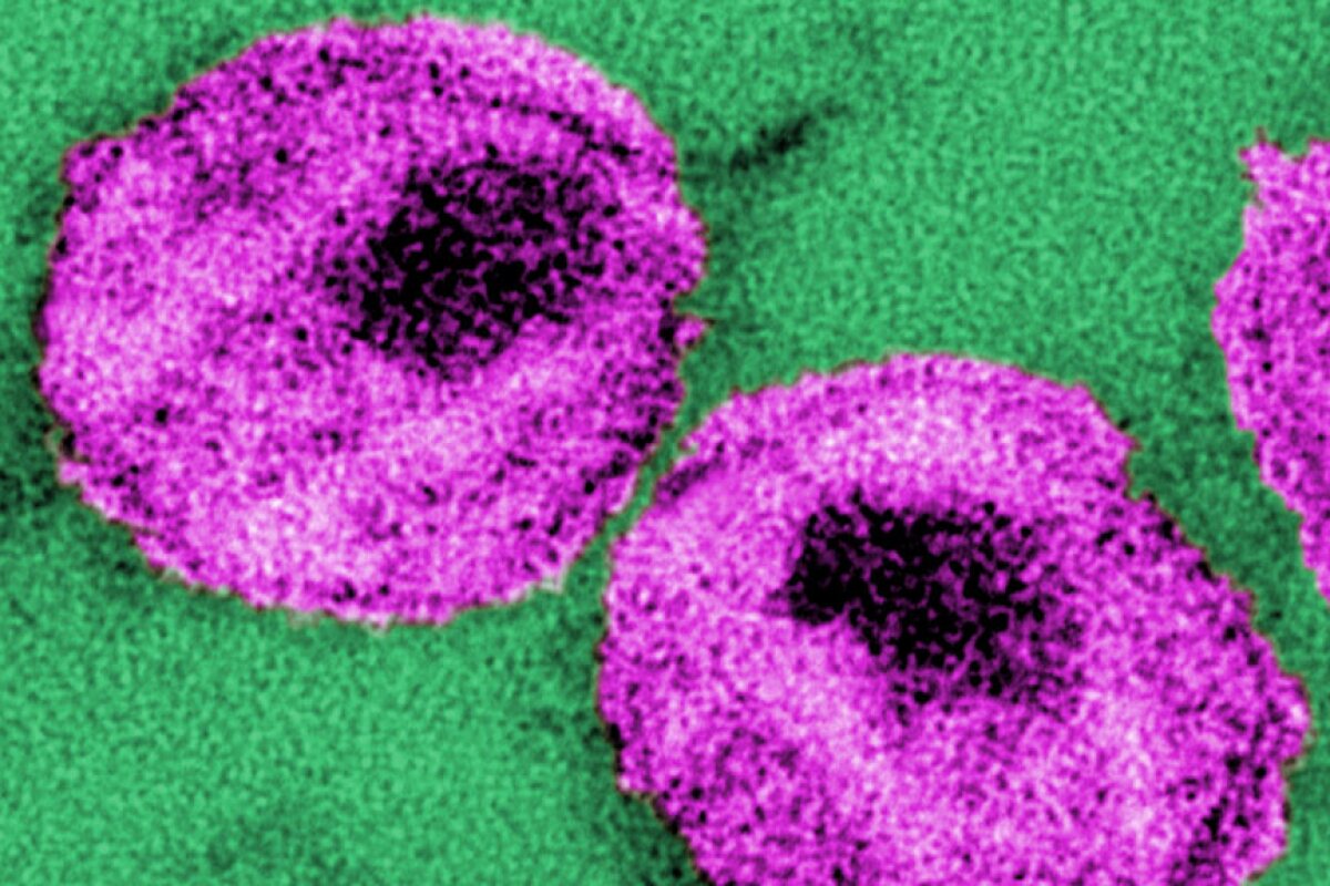 A number of HIV particles, or virions that could be targeted and killed using engineered human blood stem cells (Photo: CDC/ Dr. A. Harrison; Dr. P. Feorino)
