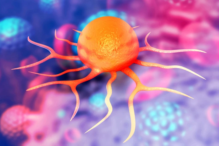 Scientists have cracked the sugary shield that allows bowel cancer to hide itself in the body