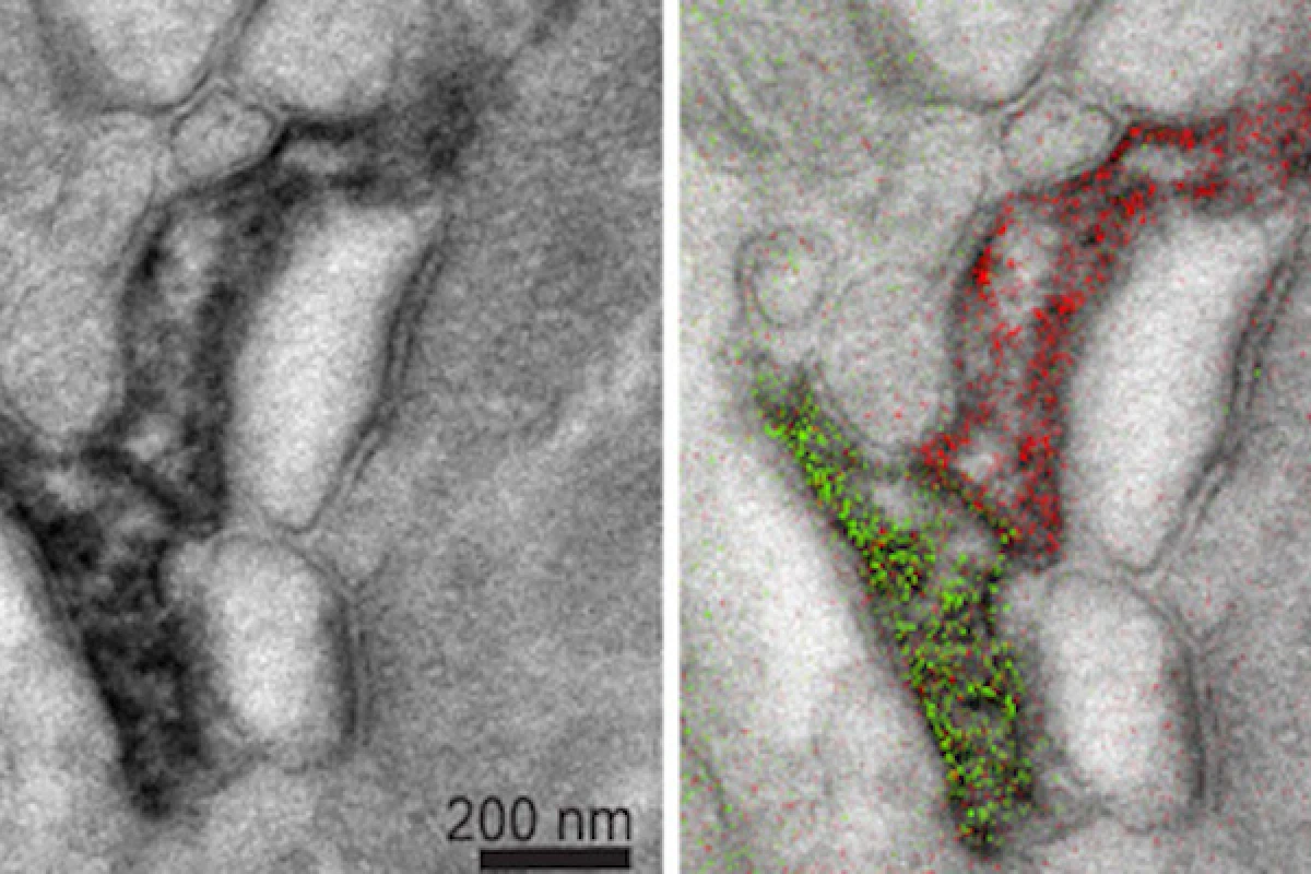 On the left is a standard grayscale electron micrograph of a mouse brain, and on the right is a Multicolor image of the same area, that better highlights the different structures and their relationship