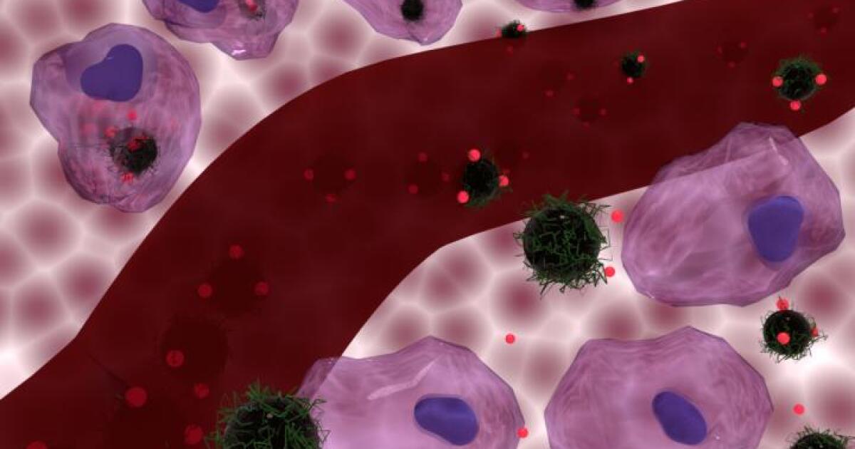 Heating Cancer Cells With Magnetic Nanoparticles Can Enhance Chemotherapy Heating Cancer Cells With Magnetic Nanoparticles Can Enhance Chemotherapy