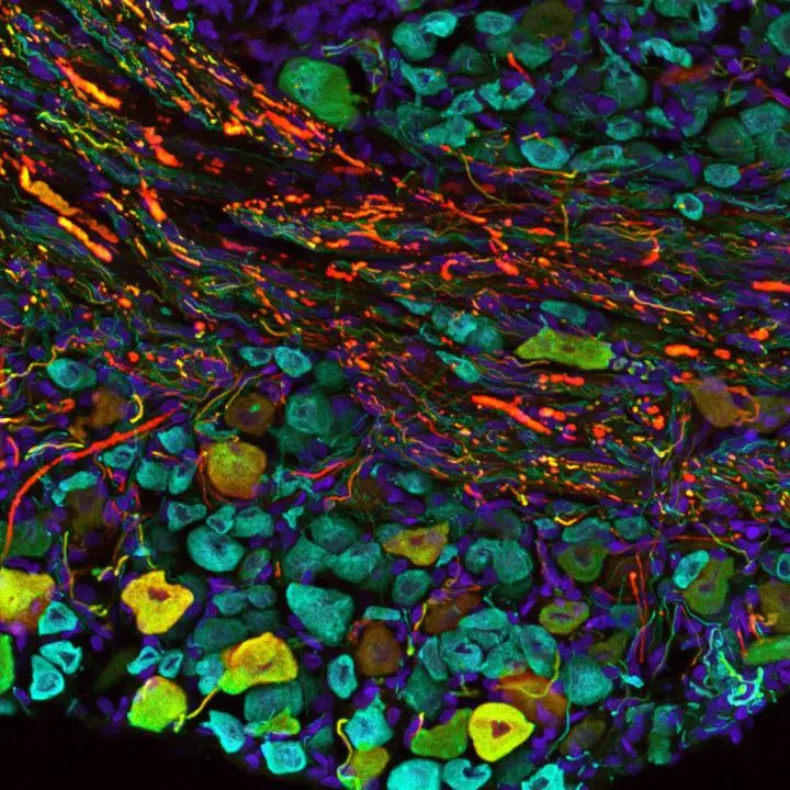 A microscope image of a bat's sensory neurons (Image: Kara Marshall/Columbia University Medical Center and Ben Falk/John Hopkins University)
