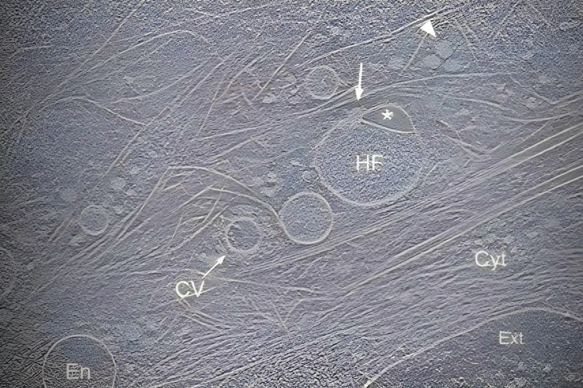The newly discovered hemifusome, labeled "HF" in this cryo-electron tomography image