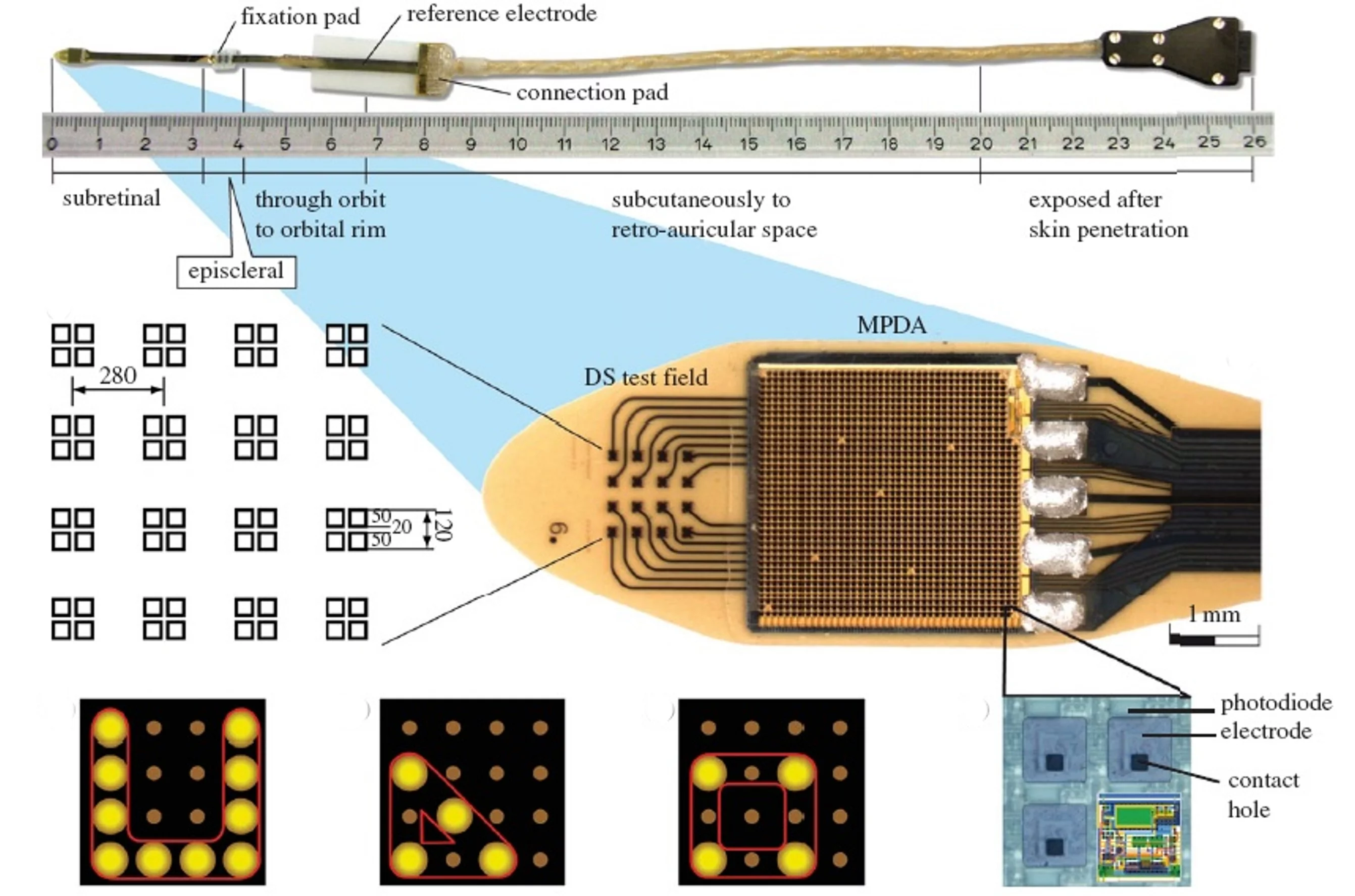 Details of the retinal implant and image resolution (Image: Retinal Implant AG)