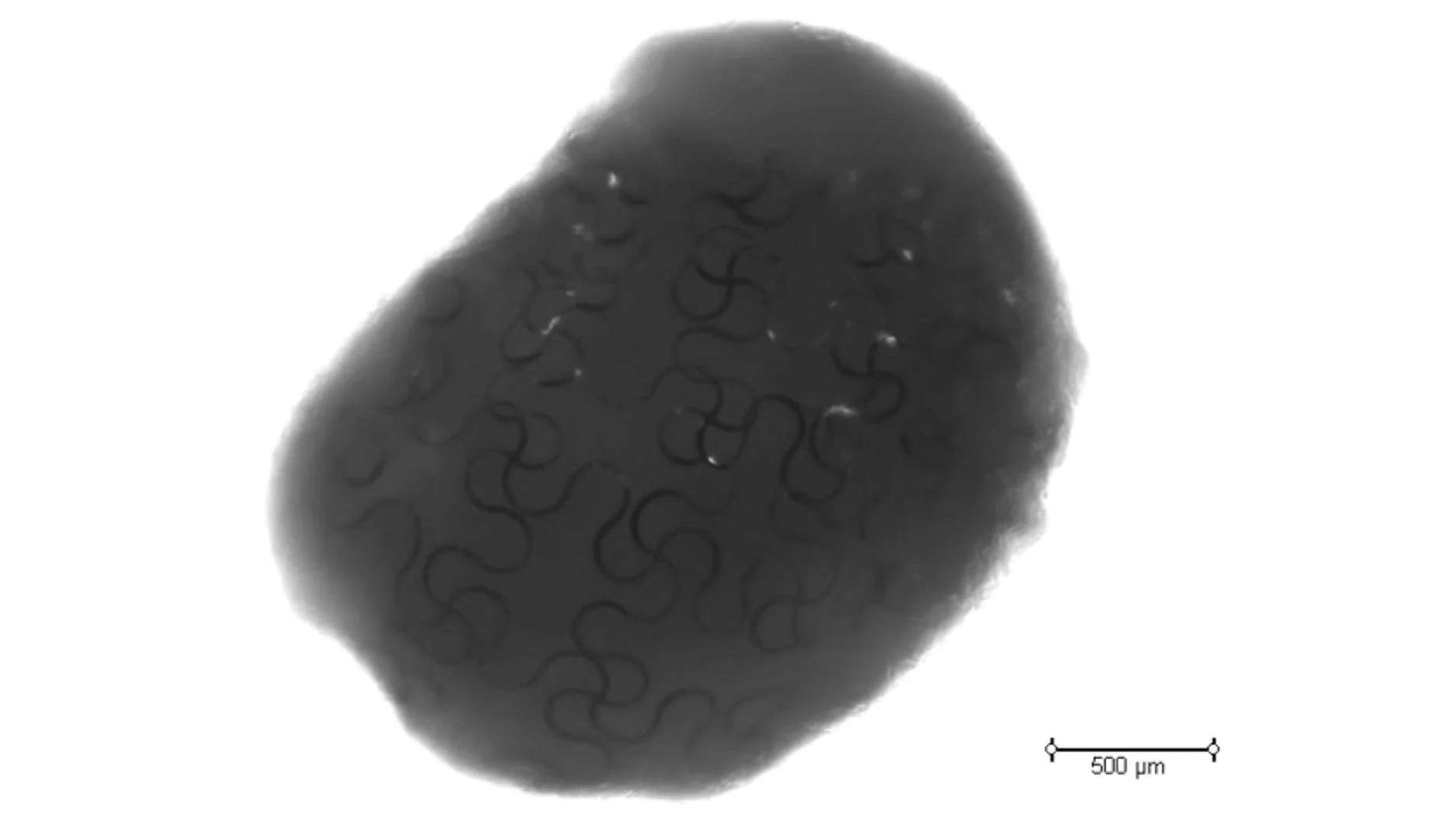A close-up of a cardiac "cyborg organoid" with an embedded nanoelectronic mesh visible inside