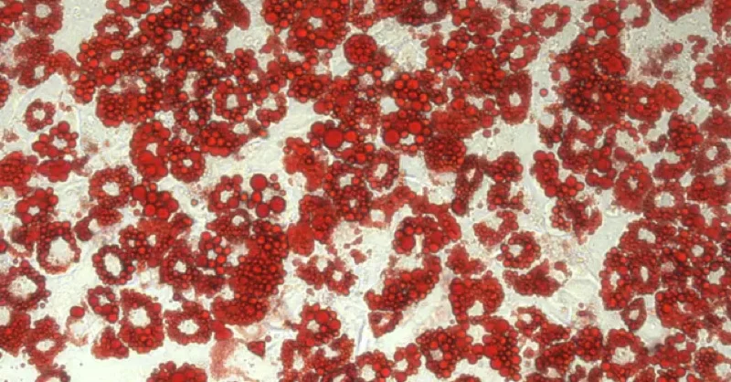 Fat cells stained for easier viewing