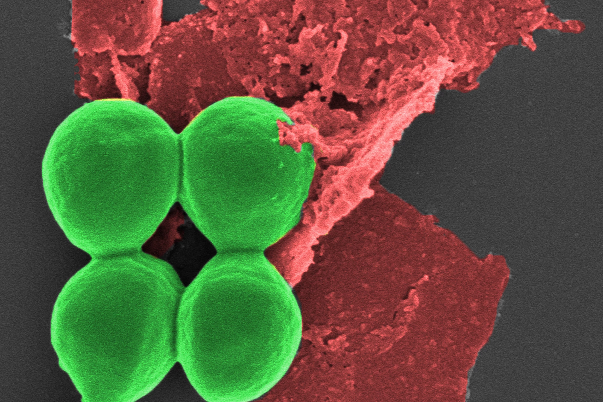 Researchers have used nano-flakes of black phosphorus (red) to kill bacteria (green)