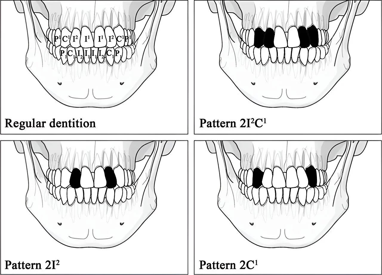 Illustration of the regular dentition and prevalent ablation patterns among ancient and contemporary populations in Taiwan