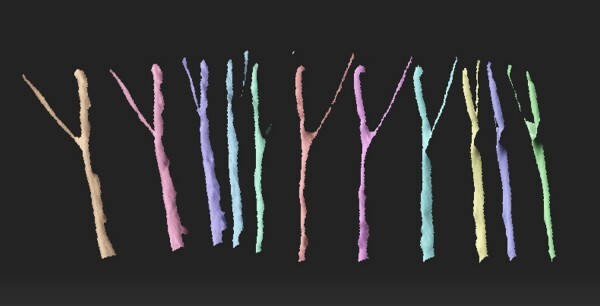 Scans of the y-shaped branching sciatic nerve