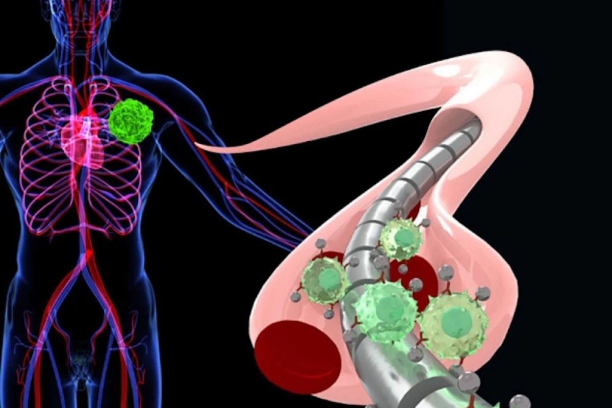 A magnetic wire attracts free-floating tumor cells that have been magnetized by specially engineered nanoparticles