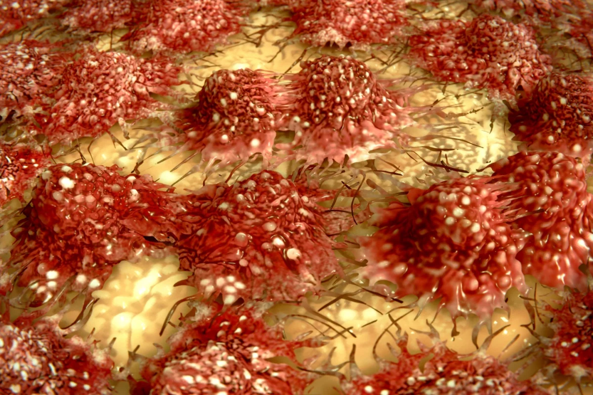 Researchers have found out why a promising class of cancer drugs failed – and how to fix them