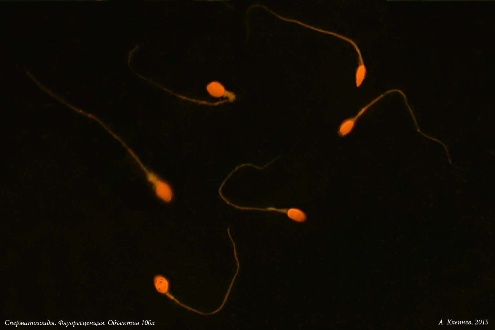 The findings may also have implications for the treatment of male infertility