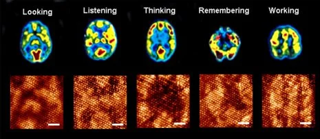Researchers have succeeded in building a molecular computer that can mimic the inner working mechanisms of the human brain