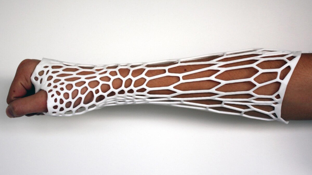 The cortex is a 3D-printed plastic cast designed to replace the traditional bulky plaster casts